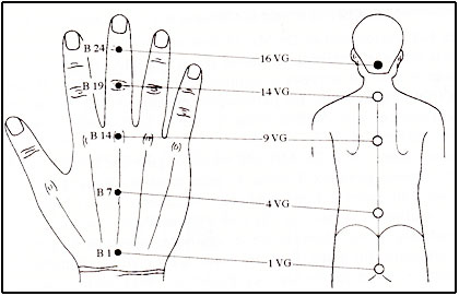 Osteokhondroz des vertèbres cervicales le coussin acheter